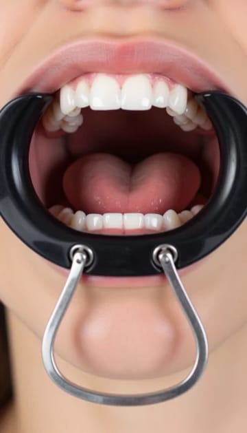 Lip Retractor